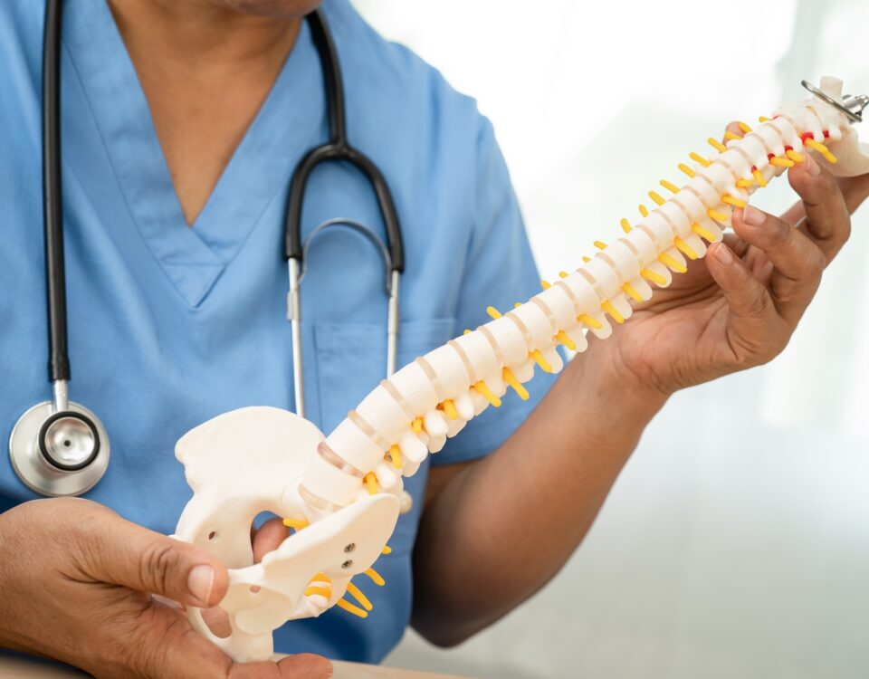 Asian doctor holding spinal nerve and bone model, Lumbar spine displaced herniated disc fragment